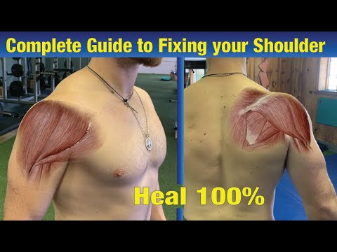 Complete Guide to Shoulder Rehab (NO SURGERY NEEDED!) - Fix Impingement & Injury Prevention
