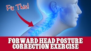 Forward Head Posture Correction Exercise - FIX Ugly Texting Neck