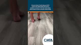Why CMT Causes Foot Deformities