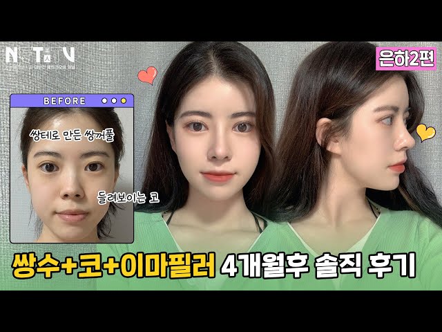e쁨, 에픽성형외과 E쁨, 에픽성형외과