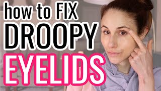 How to FIX DROOPY HOODED EYELIDS| Dr Dray