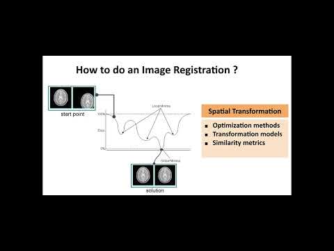 Image Registration - Part 1 - Basic Concepts