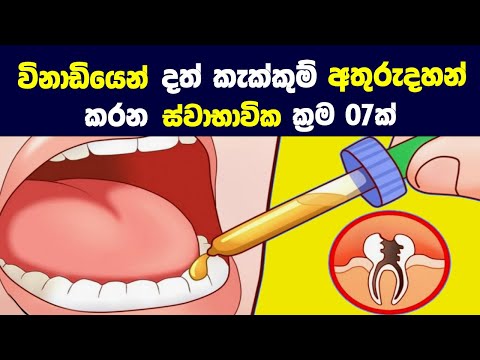 විනාඩියෙන් දත් කැක්කුම් අතුරුදහන් කරන ස්වාභාවික ක්‍රම 07ක් | 07 Home Remedies for Toothache