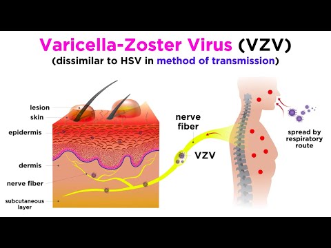 hpv rokote nimi