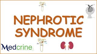 NEPHROTIC SYNDROME causes,pathophysiology,diagnosis,features and treatment