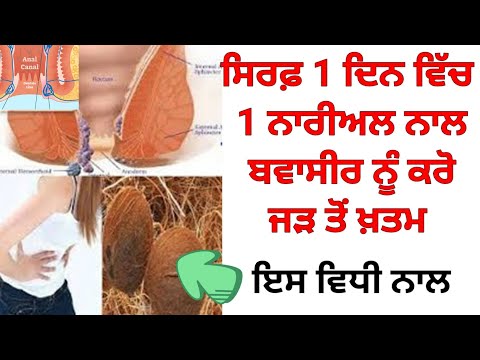 Bavasir ka ilaj treatment for piles, piles cure in 3 days l piles ka gharelu upchar, piles ke masse