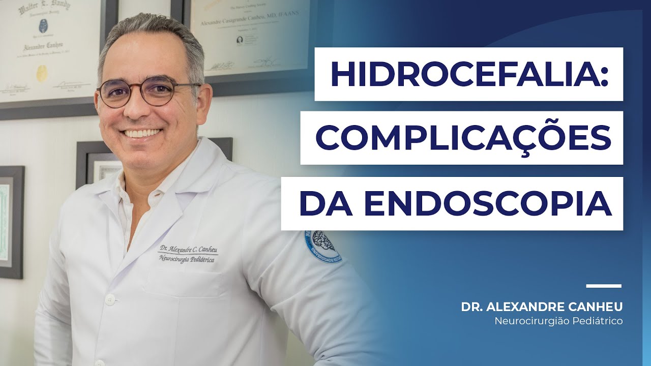 Complicações da Endoscopia Cerebral da Hidrocefalia | Dr. Alexandre Canheu