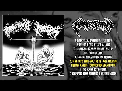 Hypertrophy - split with Insepsy (2020 - Goregrind)