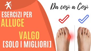 Alluce Valgo | 4 Esercizi e Strategie per non operarsi