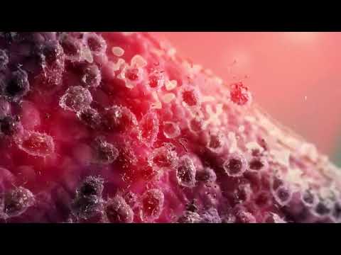 How it Works - RESONIC Tattoo Removal