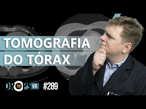 TOMOGRAFIA DO TÓRAX - SAIBA O BÁSICO!