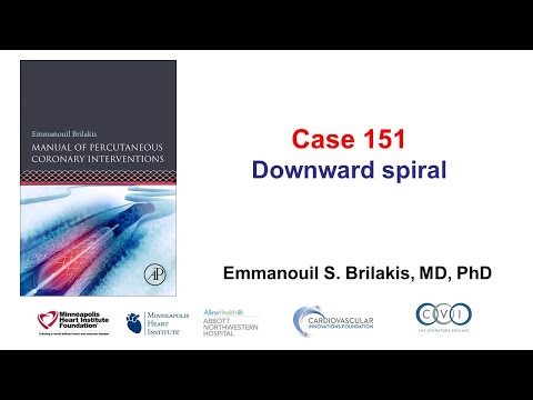 Case 151: PCI Manual - Downward spiral