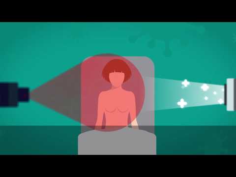 How radiotherapy works