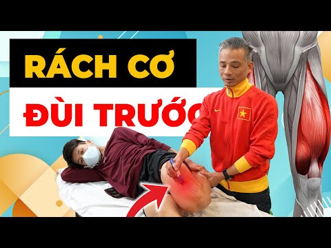 Rách Cơ Đùi Trước - Cơn Đau KINH HOÀNG Và Nguy Cơ TÀN TẬT Vĩnh Viễn!