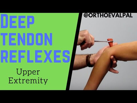 Hoffman s sign positive How to perform the test