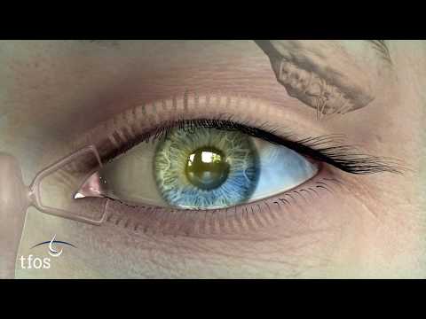 TFOS DEWS II Diagnostic Videos -  Tear Volume
