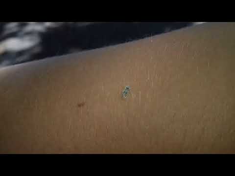 Bube Srbije-Platanova stenica (Corythucha ciliata)