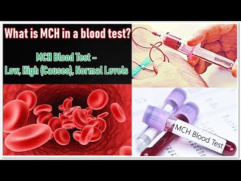 MCH Blood Test – Low, High (Causes), Normal Levels
