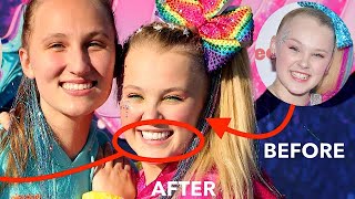 What HAPPENED to JOJO SIWA'S TEETH!?