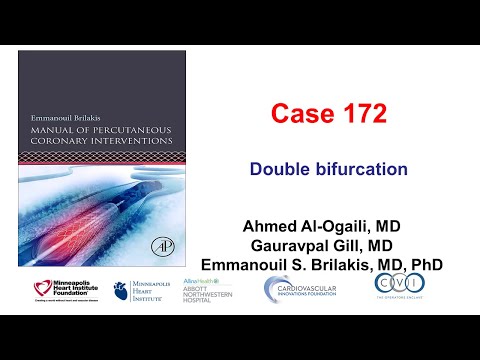 Case 172: Manual of PCI - Double  bifurcation