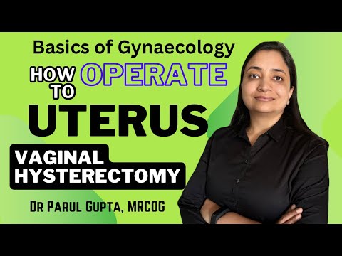 Vaginal Hysterectomy | Steps & Techniques | Viva Exam Question |