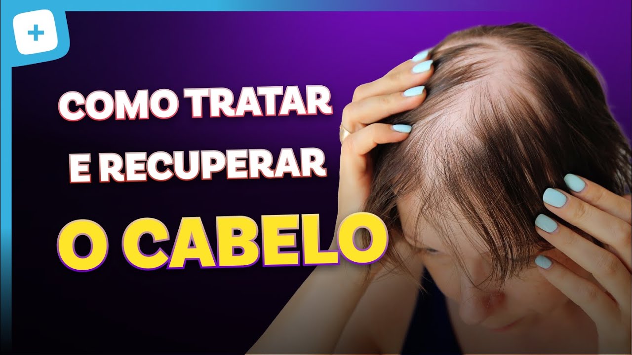 QUEDA DE CABELO em placas: Pode Ser Alopecia Areata!