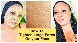 Simple Way To Tighten and Shrink Open Pores On The Face | Natural Facial Care