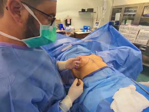 download lagu mp3 mp4 Boca Raton Breast Implants, download lagu Boca Raton Breast Implants gratis, unduh video klip Boca Raton Breast Implants