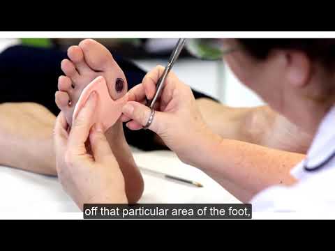 Deflective pressure relief pad for blisters