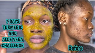TURMERIC and ALOE VERA for 7 days | how to get rid of dark spots and pigmentation EFFECTIVELY!