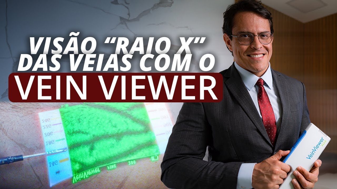 VEIN VIEWER: A Tecnologia Revolucionando o Tratamento de Varizes | Dr. Bruno Canguçu