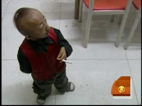 World's Shortest Man Dies