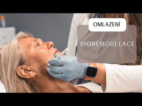 Bioremodelace kyselinou hyaluronovou ! Tváře se vyhlazují, kontury zpevňují.
