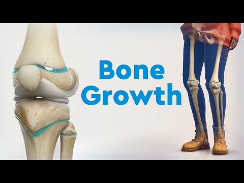 Bone Growth and Limb Deformities