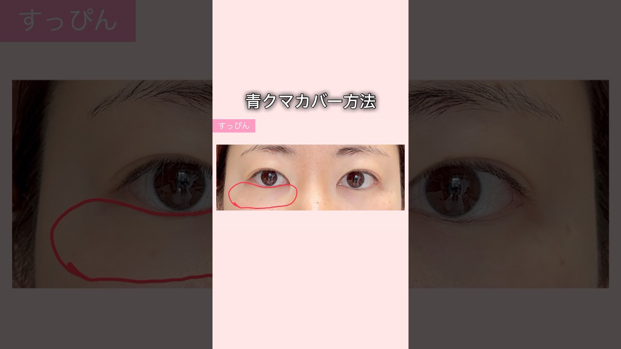 目の下青クマカバー方法｜おすすめコンシーラー