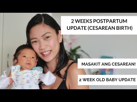 Programa para sa pagbaba ng timbang Slender review Kung paano alisin ang taba mula sa mga binti