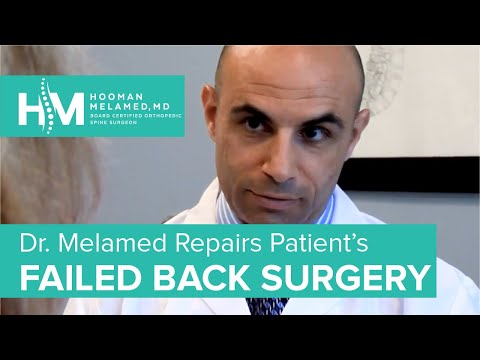 Fixing Failed Back Surgery | The Spine Pro