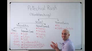 Petechial Rash - Approach