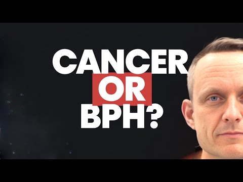 Does Having an Enlarged Prostate mean I have Prostate Cancer?