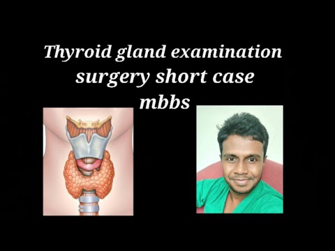 How to examine Thyroid Gland By Dr Dinusha Surgey short case