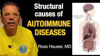 Understanding structural causes of many autoimmune diseases- Ross Hauser, MD