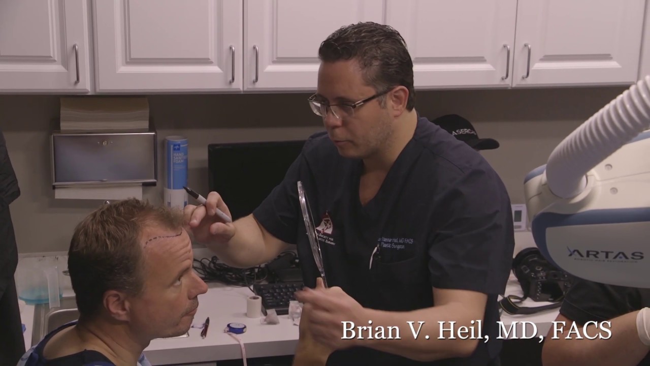 FUE Hair Transplant Pittsburgh