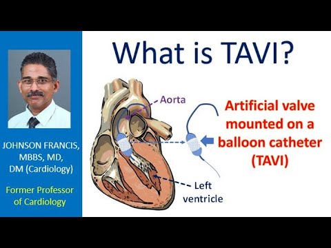 What is TAVI?