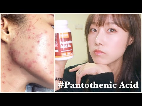 여드름 피부개선, 판토텐산 효능 및 부작용