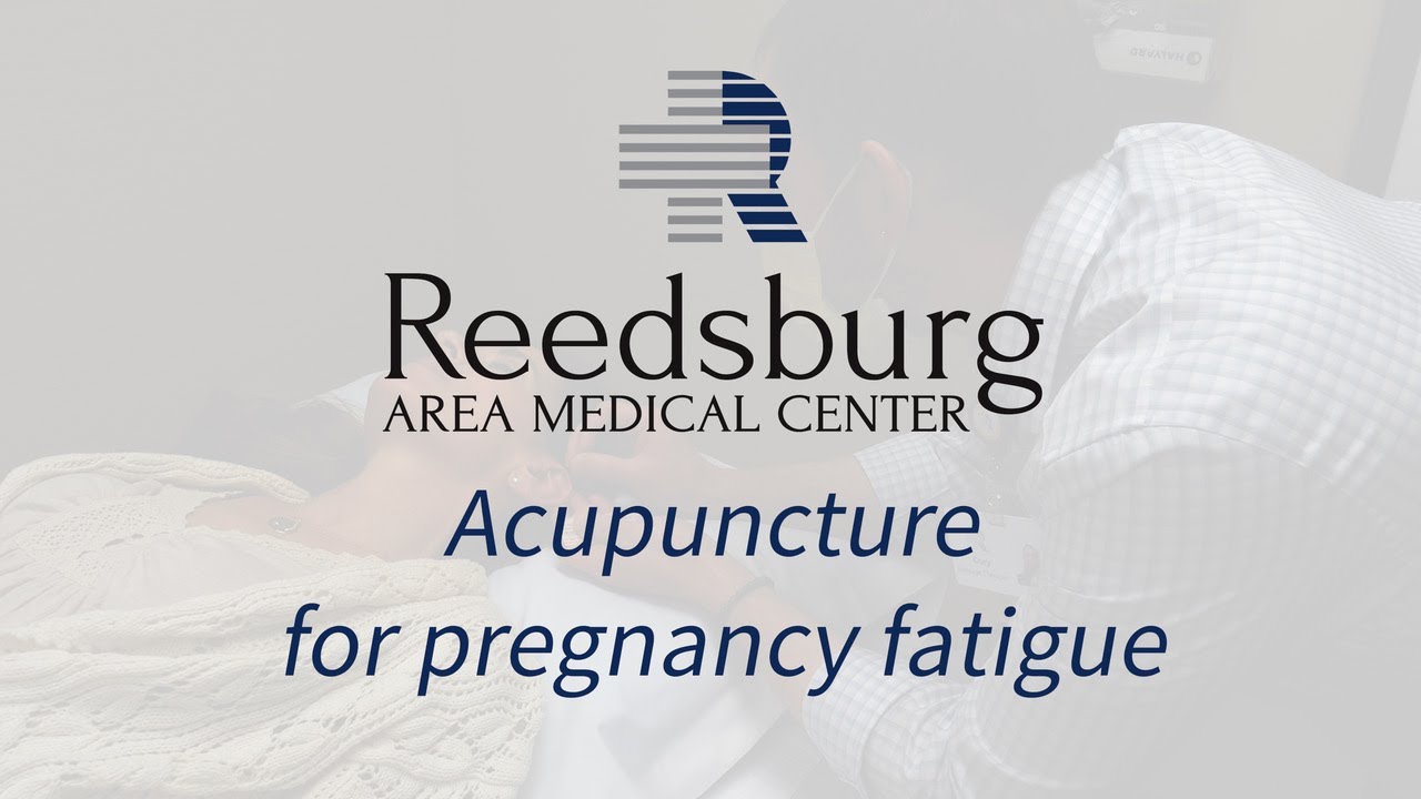 Acupuncture for Pregnancy Fatigue
