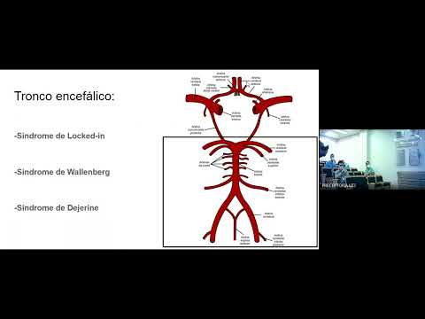 Revisão sobre Acidente vascular encefálico isquêmico