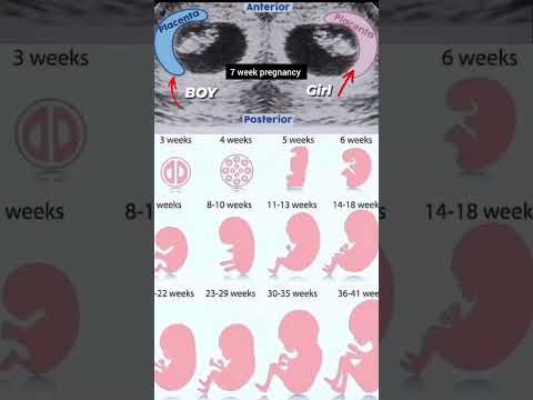 7 week pregnancy ultrasound #baby #boy #girl