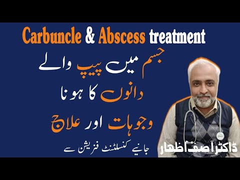 Jism Par Bar Bar Dano Ka Nikalna | Phansi Phoro Ka Ilaj | Abscess Treatment  | Skin Boils Treatment