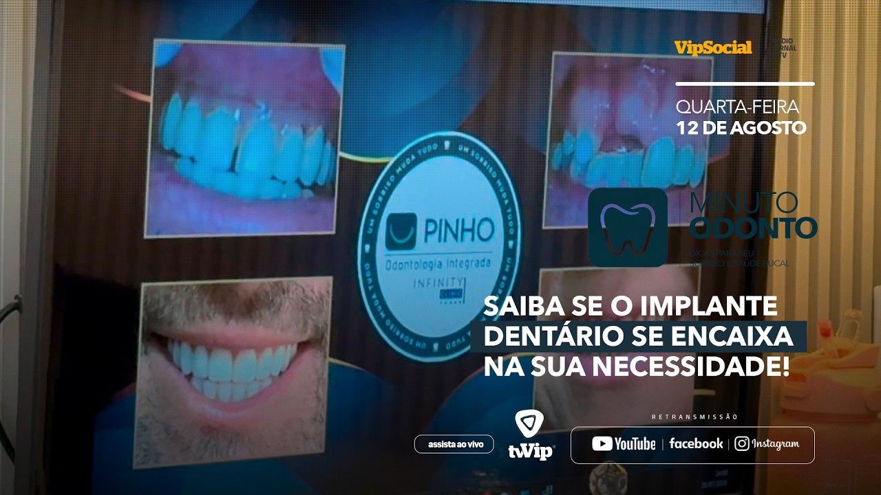 MINUTO ODONTO | Implante dentário não é exclusivo para idoso