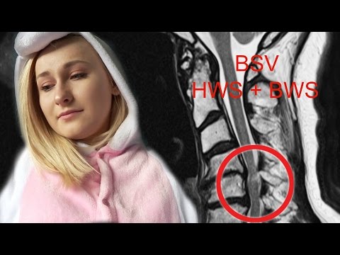 Gelenke in ihren Armen verletzt und klicken Sie auf Rückenschmerzen und Hernien, welche Symptome